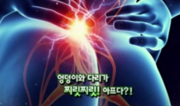 좌골신경통